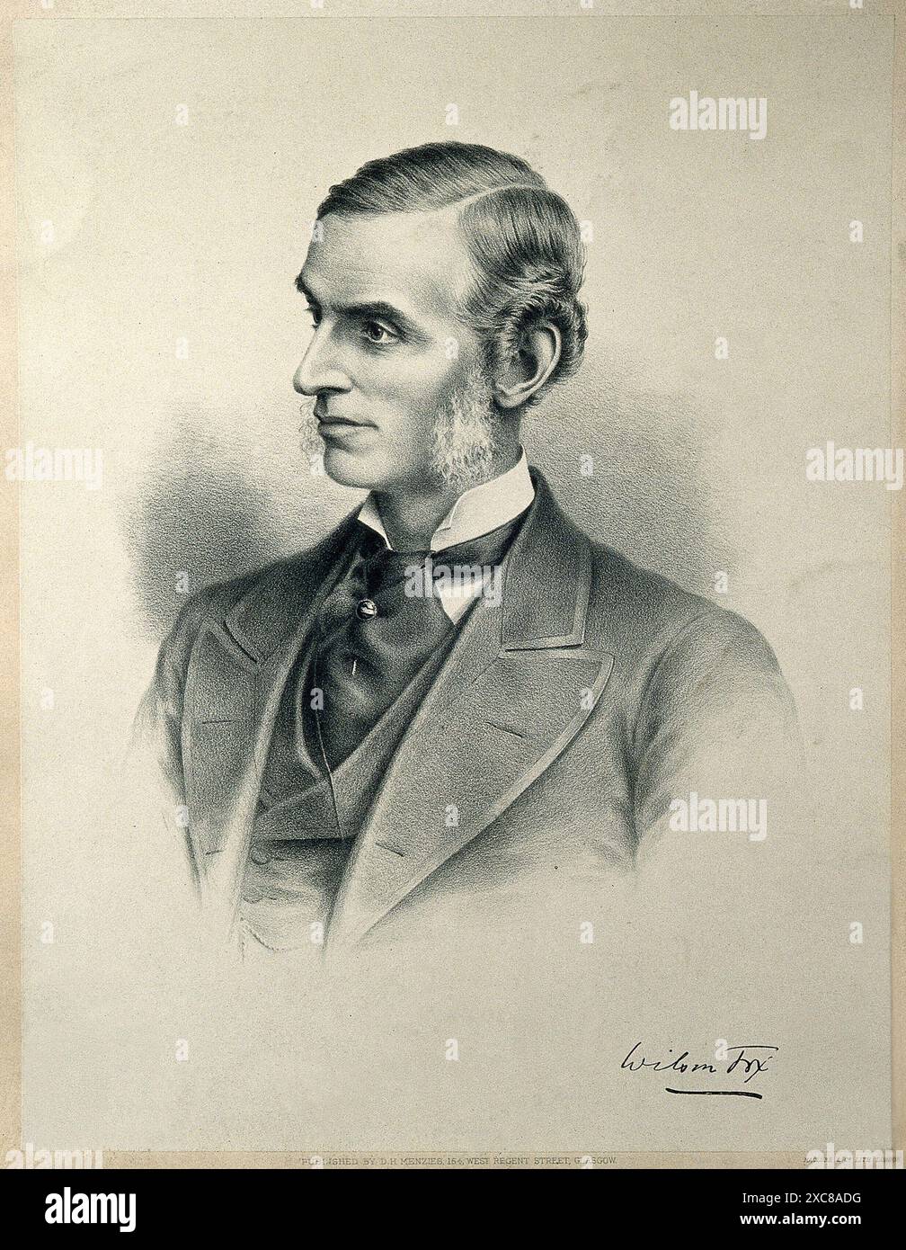 Una litografia d'epoca raffigurante Wilson Fox, un importante medico e patologo inglese. Il ritratto cattura Fox in una posa formale, mostrando il suo abbigliamento distinto e lo sguardo acuto. L'immagine risale al XIX secolo ed è una testimonianza dei contributi significativi dei Foxs nel campo della medicina. Foto Stock