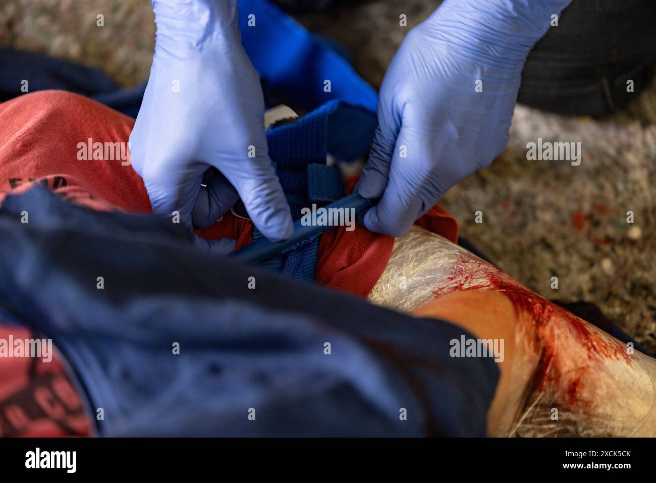 Medizin-foto 14062024 - Ein Tourniquet, auch Drehkreuz oder Aderpresse genannt, ist ein Abbinde-System zur Stauung oder kurzzeitigen Unterbrechung des arteriellen Blutflusses bei schweren Verletzungen in Notsituationen. Symbolbild Medizin bei einem Training in einem Trauma-Kurs in Weeze NRW. Weeze Nordrhein-Westfalen Deutschland *** Medicina foto 14062024 Un laccio emostatico, noto anche come laccio emostatico o pressa emostatico, è un sistema di legatura per congestione o interruzione temporanea del flusso sanguigno arterioso in caso di lesioni gravi in situazioni di emergenza immagine simbolica Medicina durante il treno Foto Stock