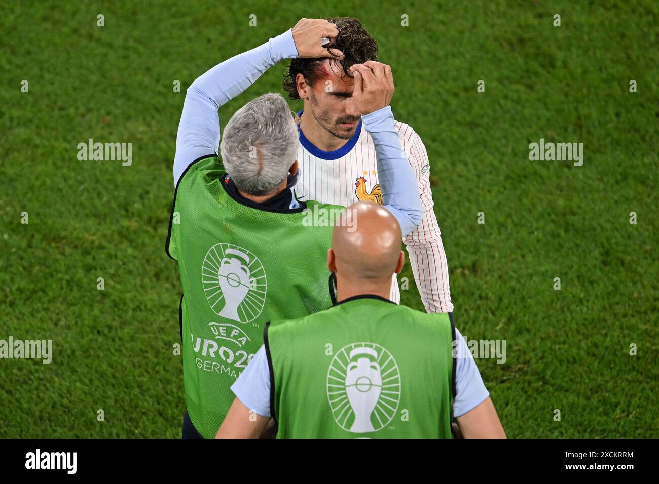 Duesseldorf, Germania. 17 giugno 2024. Calcio, UEFA Euro 2024, Campionato europeo, turno preliminare, gruppo D, giorno 1, Austria - Francia, Düsseldorf Arena, il francese Antoine Griezmann riceve un trattamento sulla sua testa. Crediti: Fabian Strauch/dpa/Alamy Live News Foto Stock