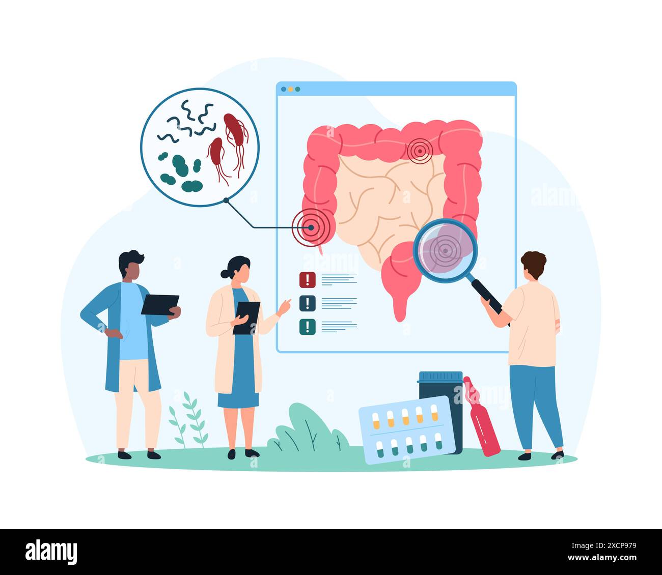 Crescita eccessiva di batteri nocivi nell'intestino, infiammazione nel tratto gastrointestinale. Piccole persone con lente d'ingrandimento ricerca microbi piccoli e bacillo nell'illustrazione vettoriale di cartoni animati dell'intestino umano Illustrazione Vettoriale