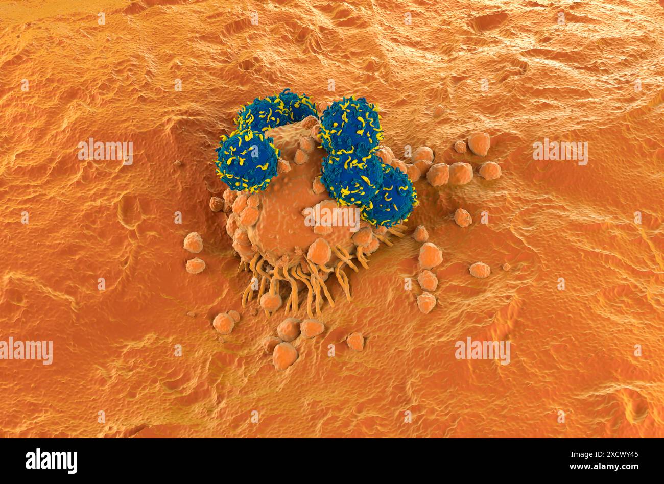 Terapia con cellule T DELL'AUTOMOBILE nel melanoma - Vista isometrica illustrazione 3d. Foto Stock