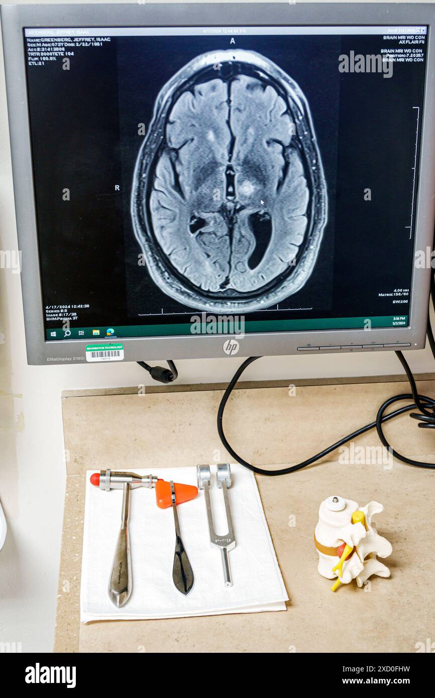 Miami Kendall Florida, Baptist Health South Florida Hospital, schermo del computer di scansione del cervello, sala esame dell'ufficio del neurochirurgo, martello riflesso medico, sintonizzazione per Foto Stock