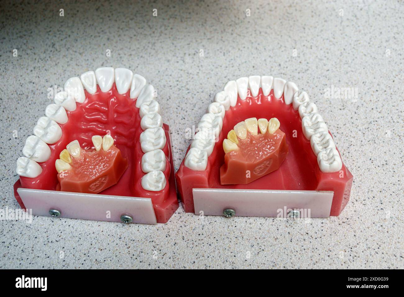 Miami Beach Florida, Miami Beach Community Health Center, studio dentistico, interno, denti umani modello a grandezza naturale, visitatori in visita viaggio trav Foto Stock