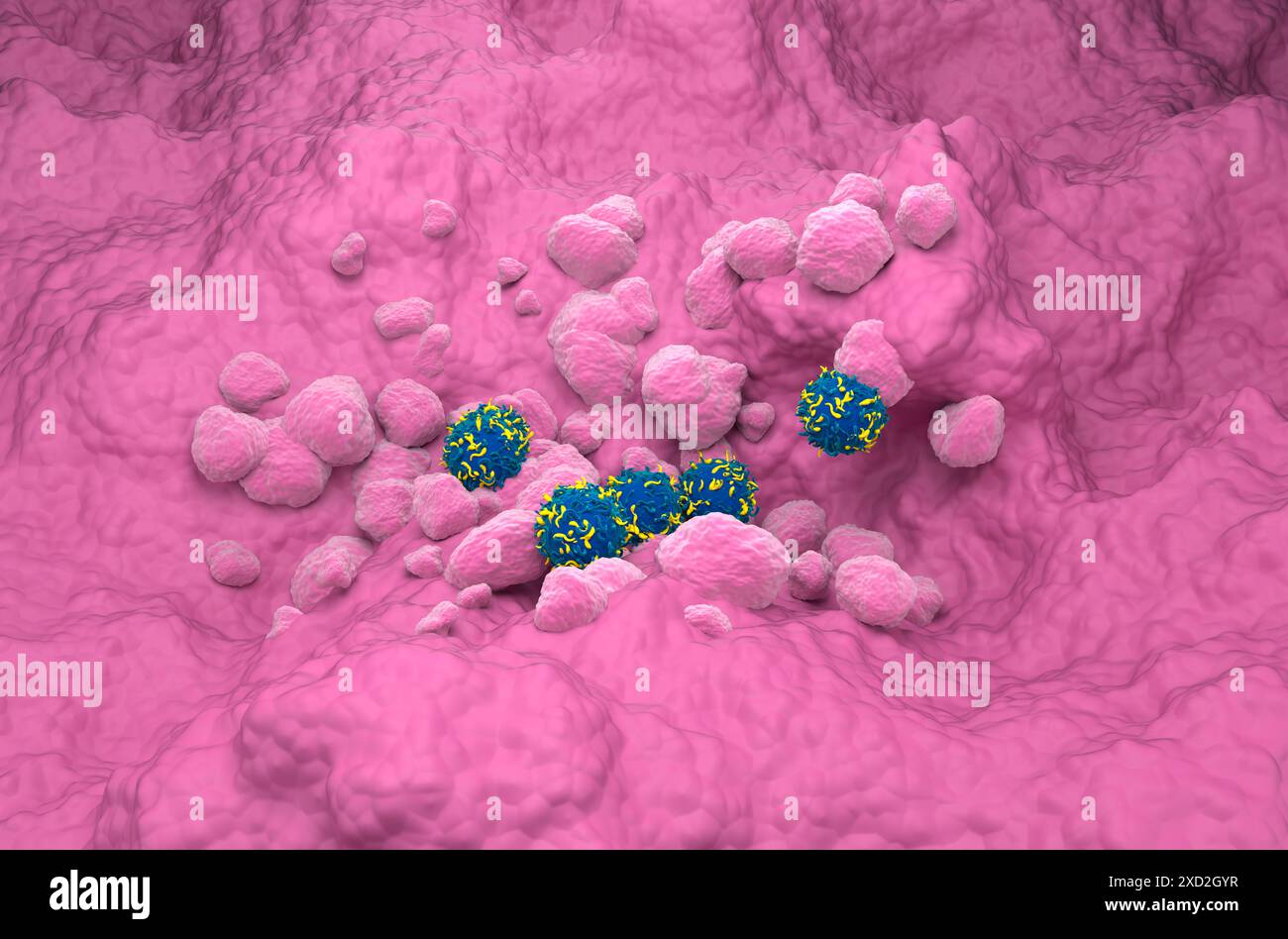 Terapia con cellule T di CAR nel cancro polmonare - Vista isometrica illustrazione 3d. Foto Stock