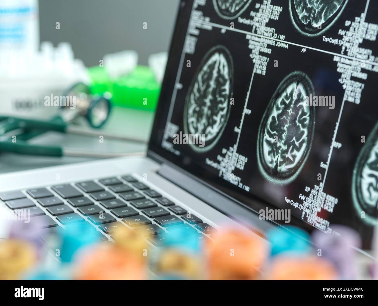 Scrivania del medico con campioni medici e la scansione del cervello di un paziente sul computer portatile durante una consultazione. Foto Stock