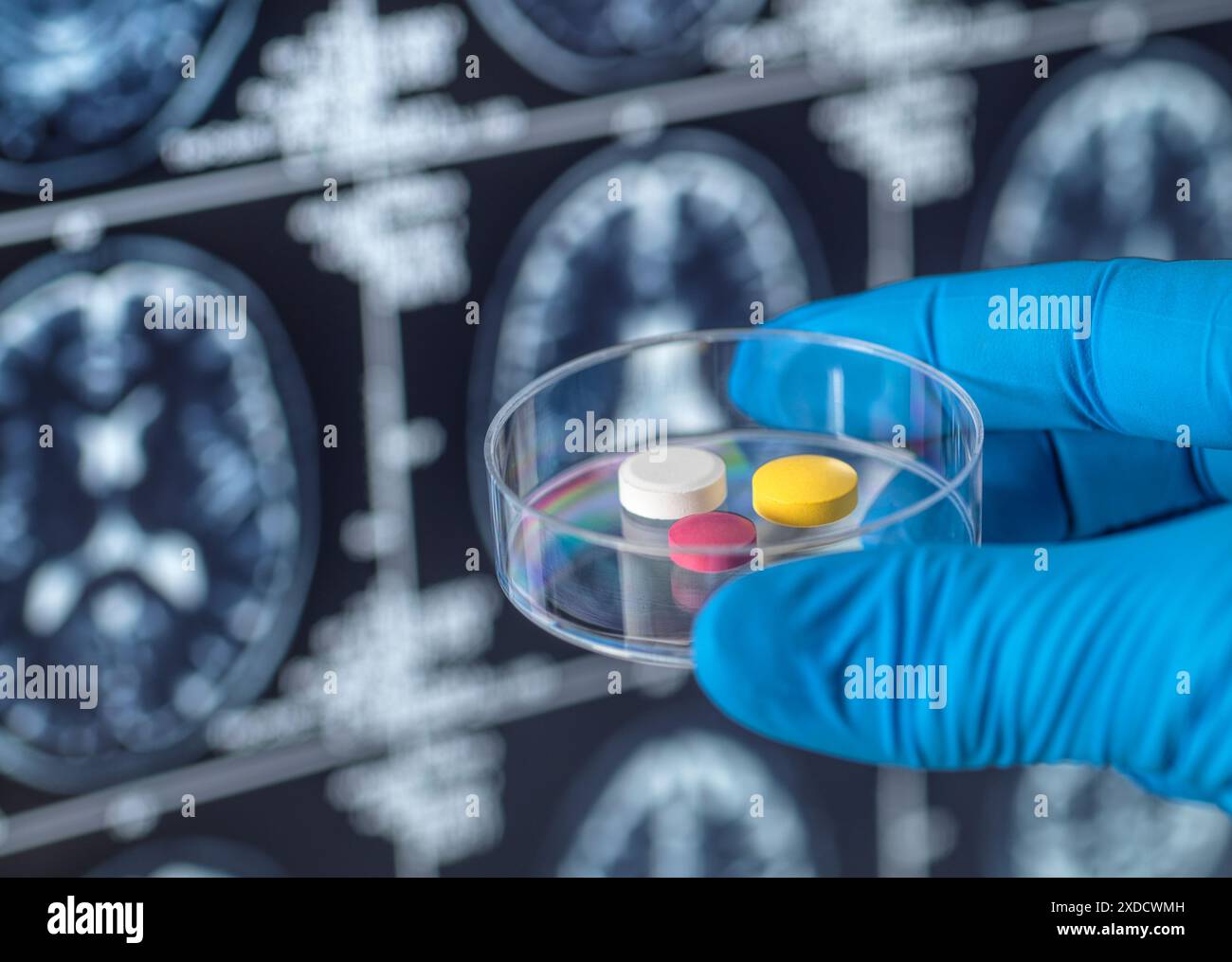 Scienziato che tiene in piedi una potenziale cura per la demenza e il morbo di Alzheimer di fronte a una risonanza magnetica del cervello (risonanza magnetica) scansione durante un percorso clinico. Foto Stock