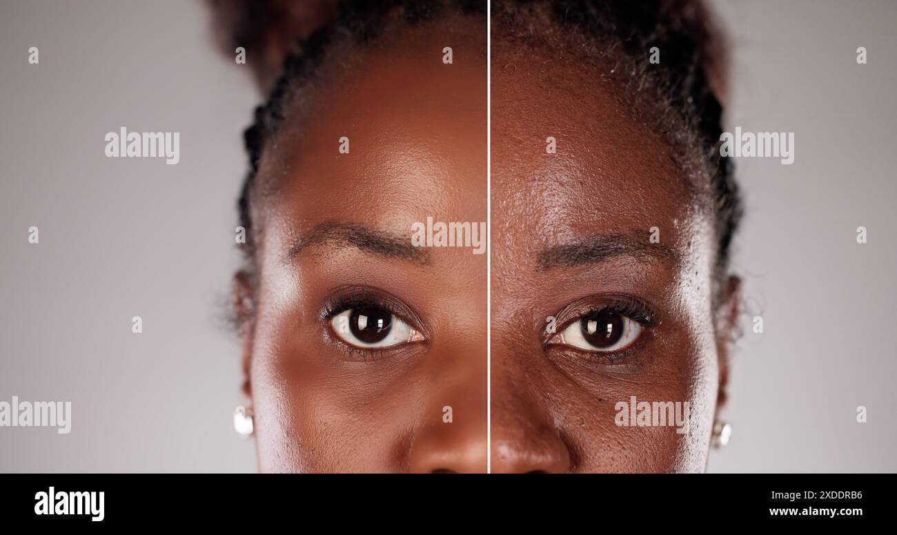 Trasformazione giovanile: Un futuro più luminoso per la tua pelle con trattamento antirughe prima e dopo le foto di un estetista. Foto Stock