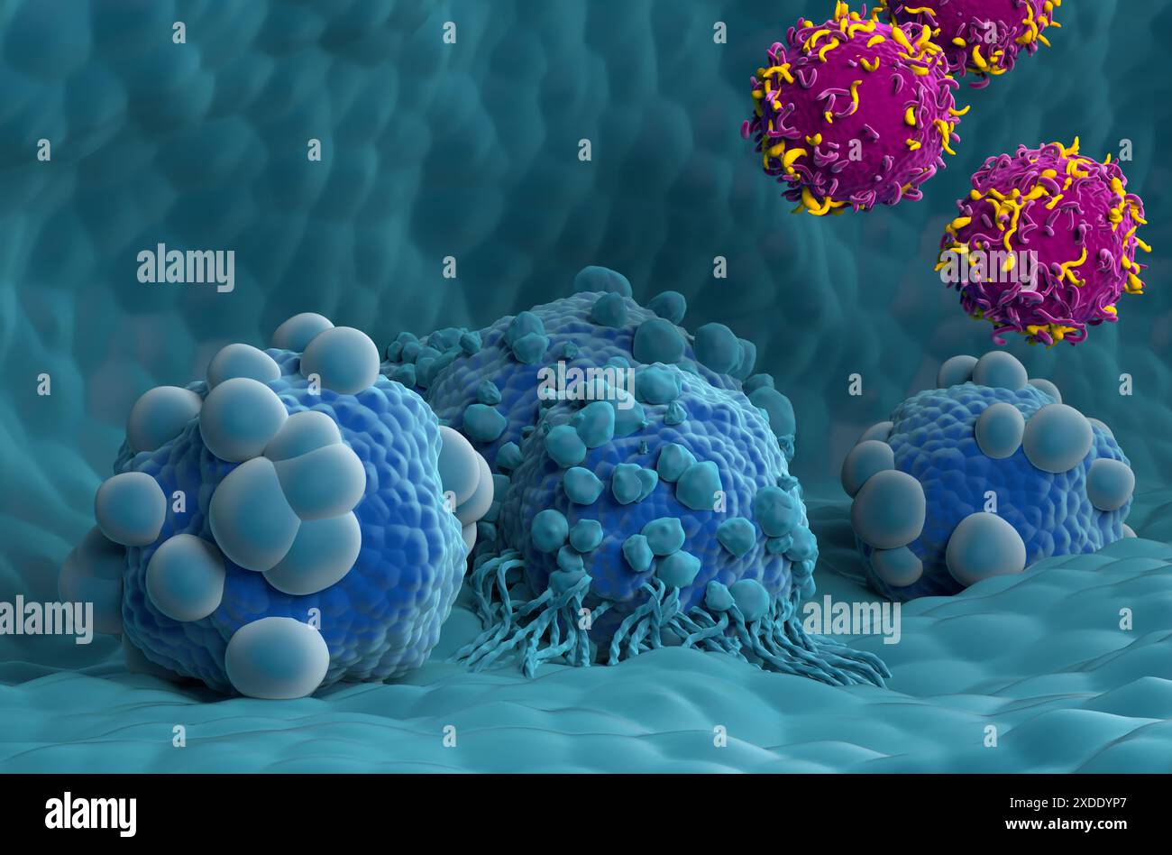 Terapia con cellule T di CAR nel cancro del pancreas - Vista ravvicinata illustrazione 3d. Foto Stock