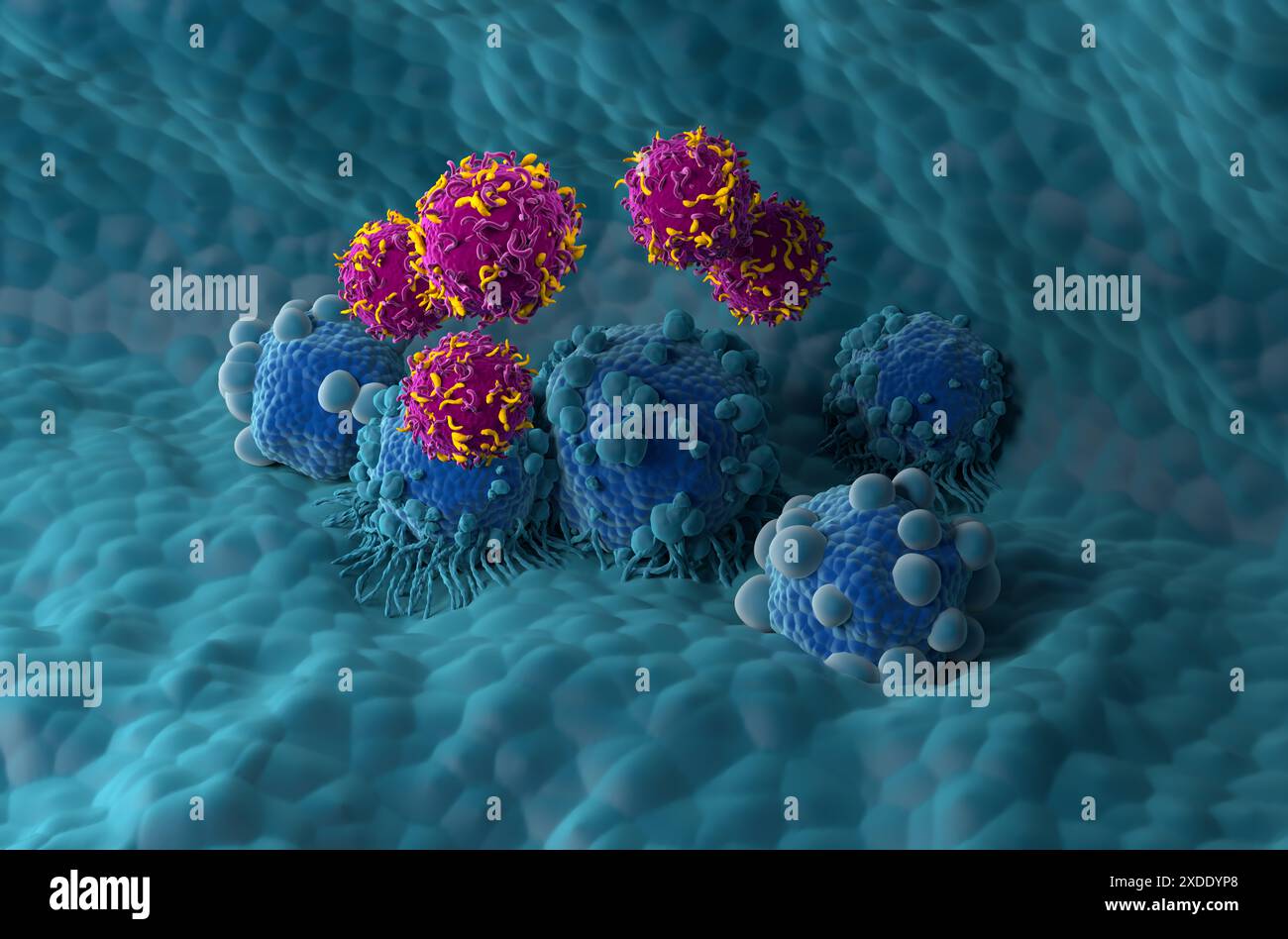 Terapia con cellule T di CAR nel cancro del pancreas - Vista isometrica illustrazione 3d. Foto Stock