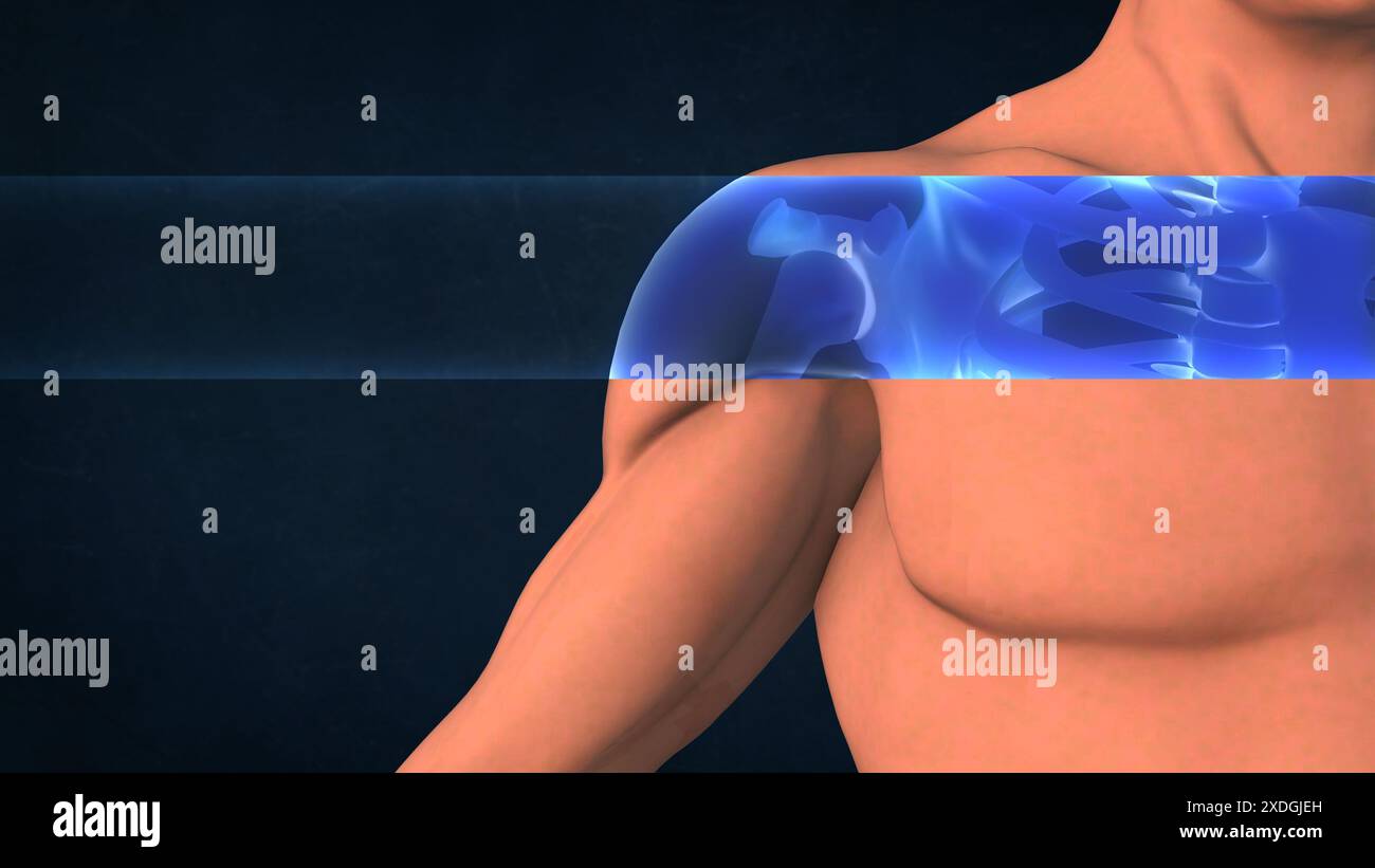 Una radiografia di una spalla umana Foto Stock