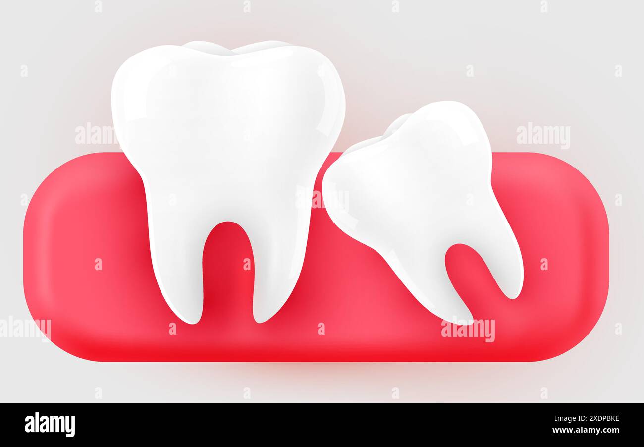 Dente con gengive, illustrazione 3D di un dente su uno sfondo chiaro. Illustrazione vettoriale Illustrazione Vettoriale