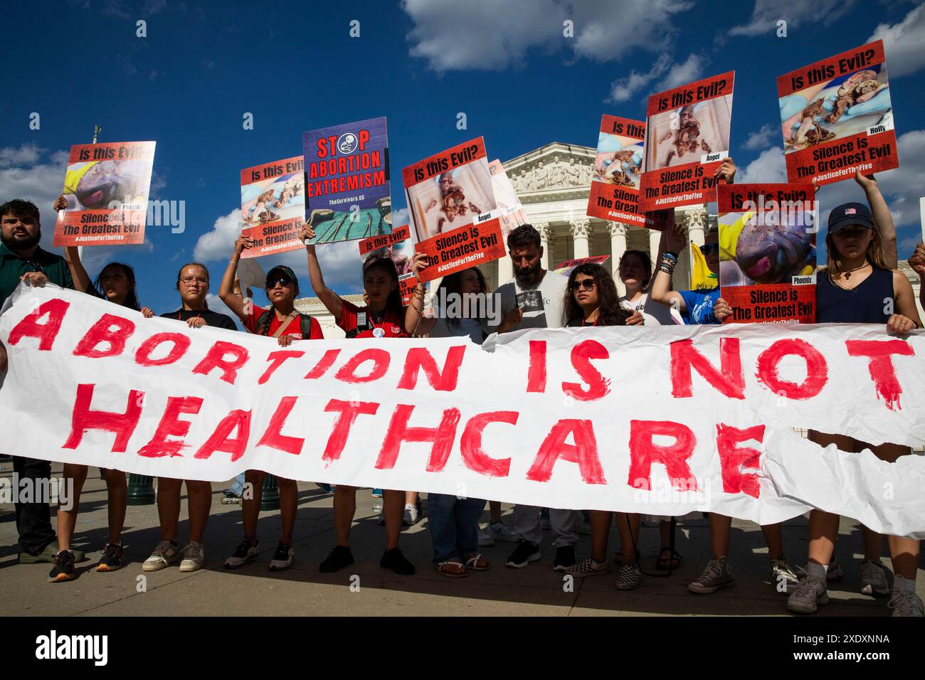 Washington, DC, USA. 24 giugno 2024. Gli attivisti per i diritti anti-aborto stanno protestando e mostrando uno striscione davanti alla Corte Suprema degli Stati Uniti a Washington, DC, il 24 giugno 2024. Questa manifestazione segna il secondo anniversario della sentenza Dobbs contro Jackson Women's Health Organization, che ha invertito le protezioni federali per l'accesso agli aborti. (Foto di Aashish Kiphayet/Sipa USA) credito: SIPA USA/Alamy Live News Foto Stock