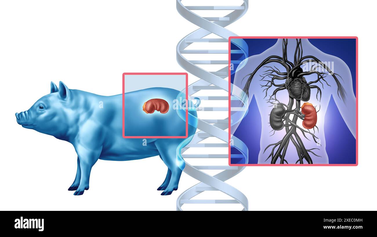 Concetto di trapianto di rene di maiale come organo animale geneticamente modificato trasferito all'uomo come trapianto xenotrapianto xenogenico Foto Stock