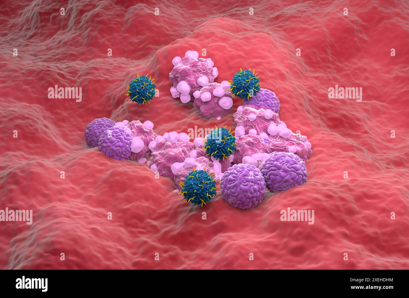 Terapia con cellule T di CAR nel cancro ovarico - Vista isometrica illustrazione 3d. Foto Stock