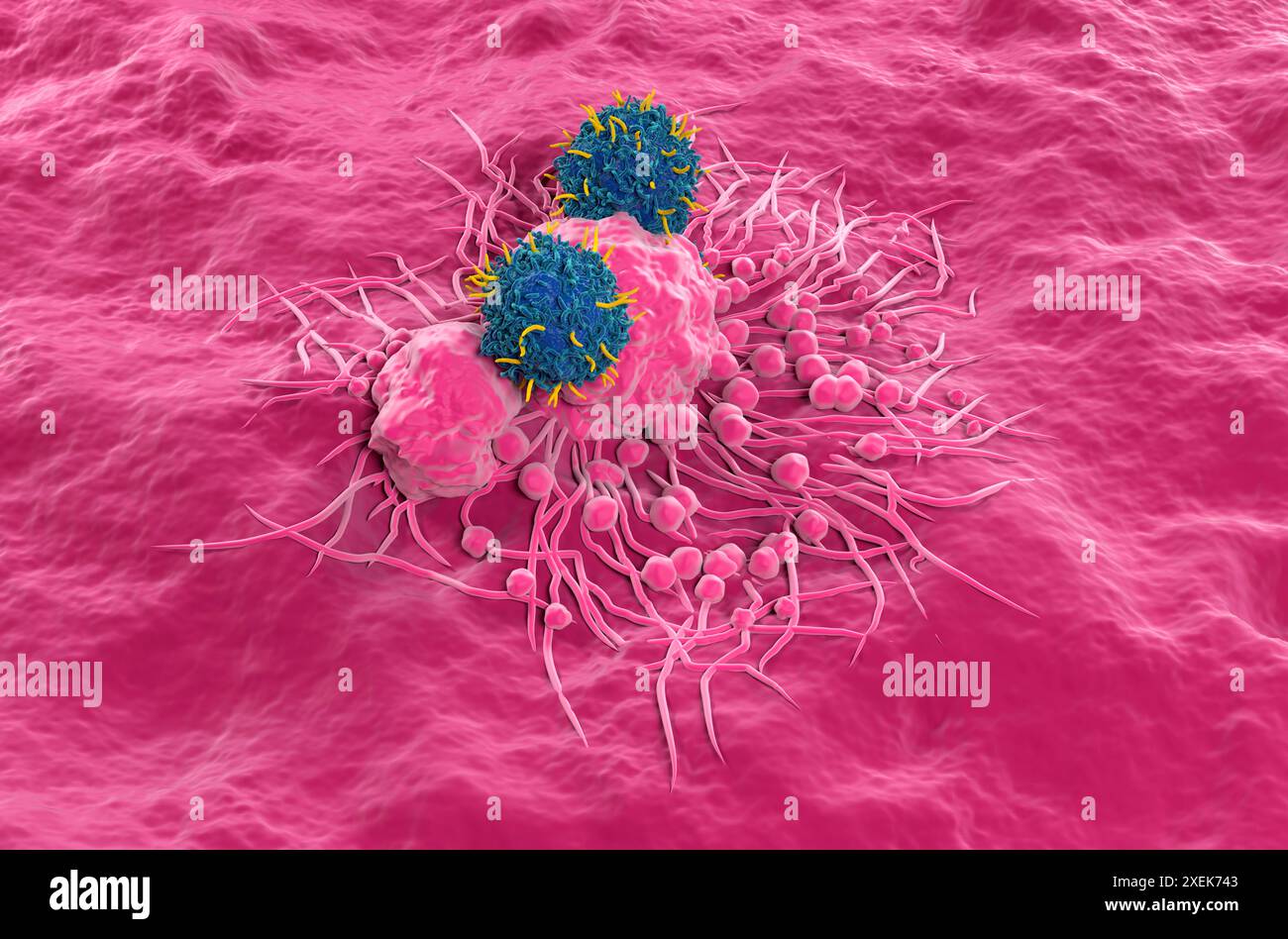 Terapia con cellule T di CAR nel cancro della tiroide - Vista isometrica illustrazione 3d. Foto Stock