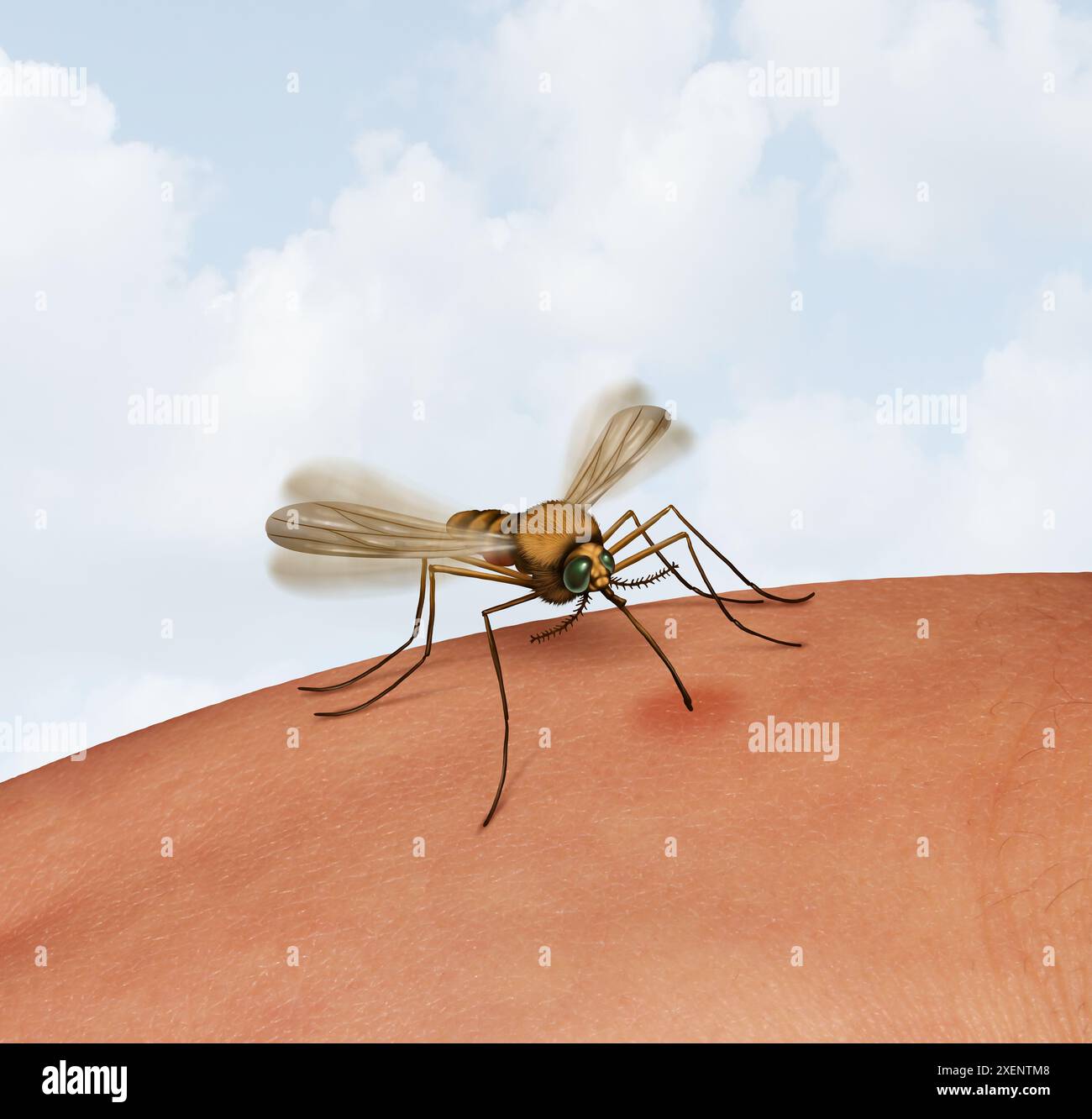 Febbre dengue come malattia trasmessa dalle zanzare o febbre delle ossa o infezione virale causata da zanzare che provoca il virus Zika del Nilo occidentale o la malaria. Foto Stock