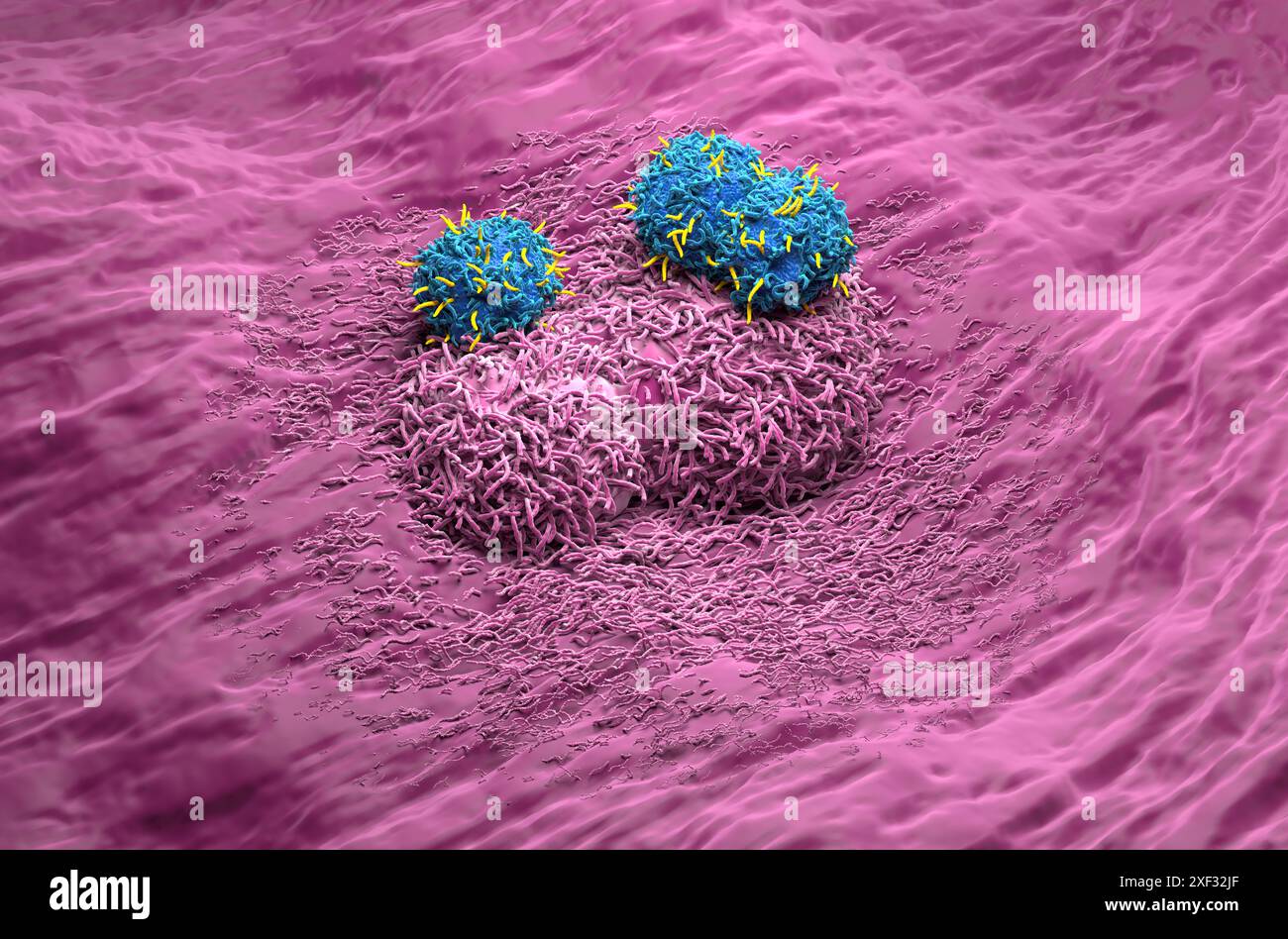 Terapia con cellule T di CAR nel cancro del fegato - Vista isometrica illustrazione 3d. Foto Stock