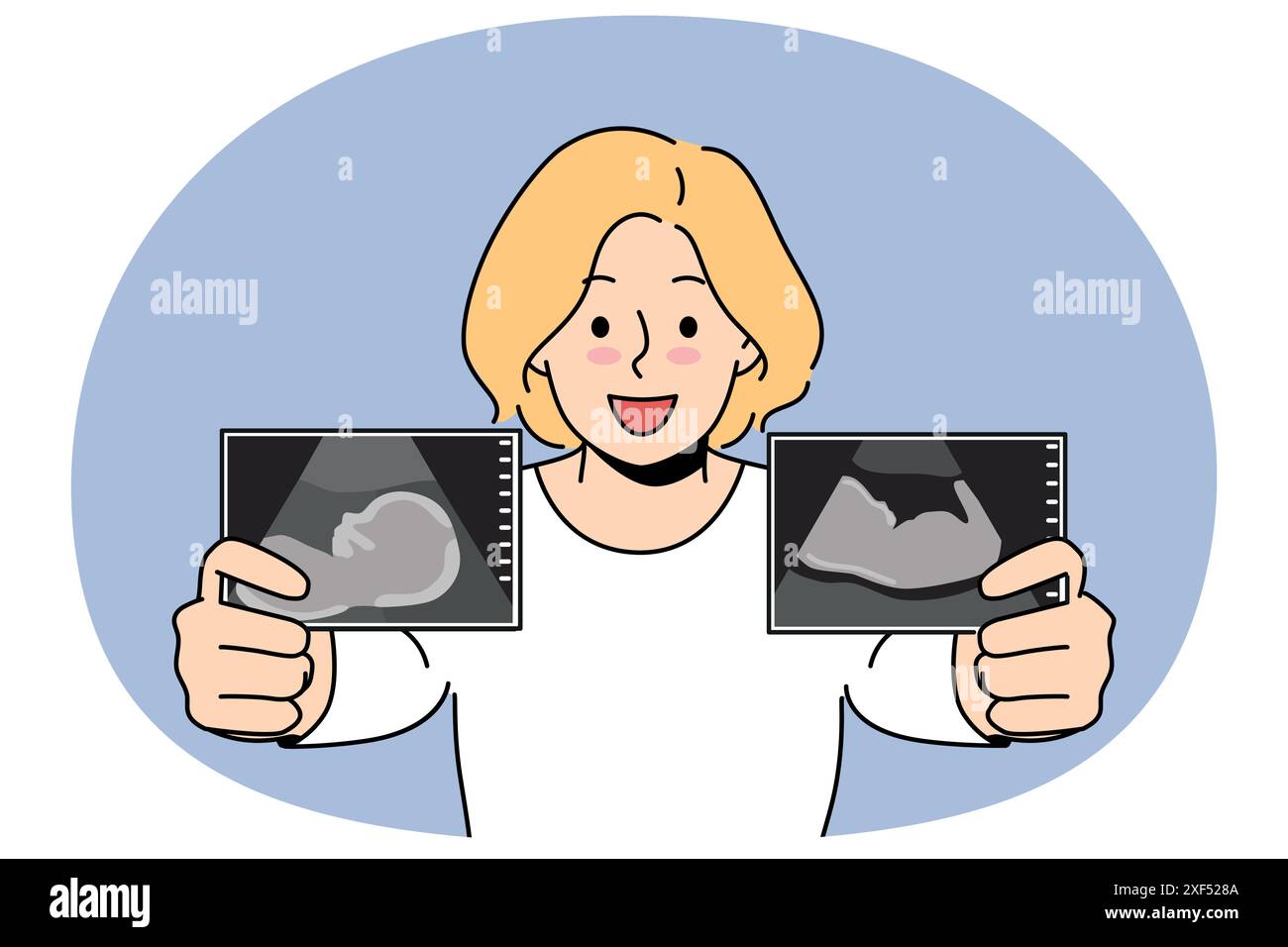 La donna incinta vanta immagini ecografiche del bambino nell'utero della futura madre nel periodo prenatale. La ragazza bionda incinta sorride e si prepara a diventare mamma e dare alla luce un neonato sano Illustrazione Vettoriale