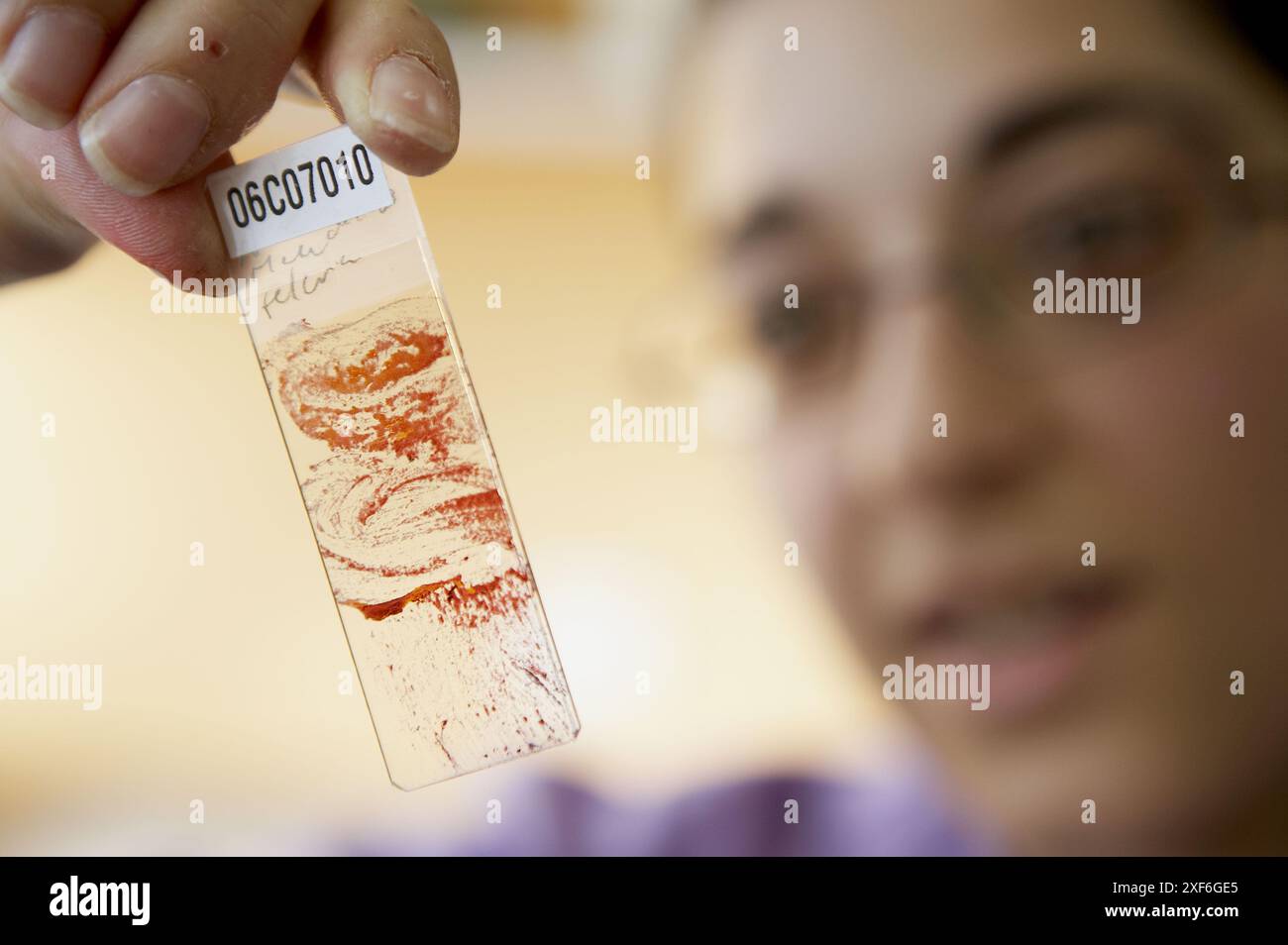 Campione, anatomia patologica. Hospital de Zumarraga, Gipuzkoa, Euskadi, Spagna Foto Stock