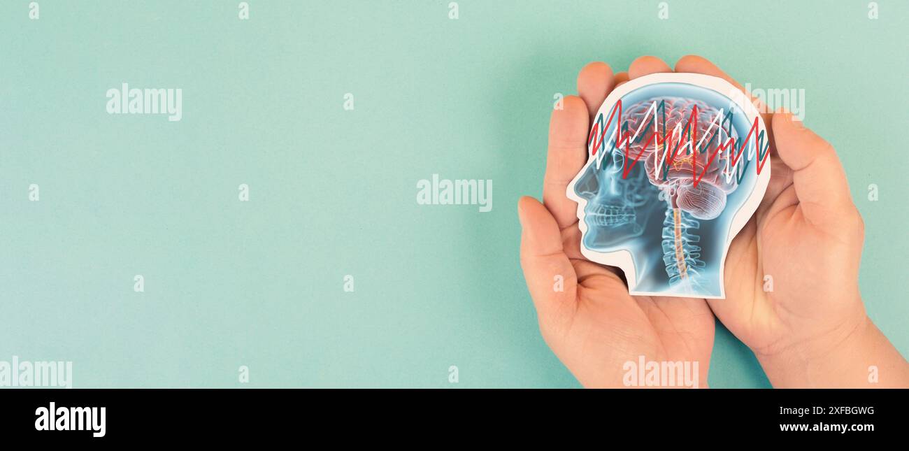 Epilessia, cervello con convulsioni, EEG, attività elettrica della mente, consapevolezza di alzheimer, diagnosi di demenza, morbo di Parkinson, disturbo di perdita di memoria Foto Stock