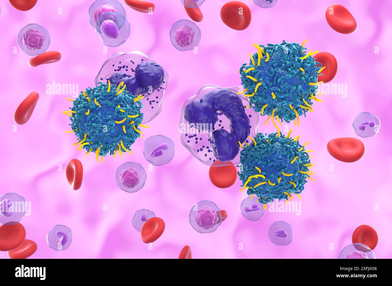 Terapia con cellule T di CAR nella leucemia mielogena cronica (LMC) - Vista ravvicinata illustrazione 3d. Foto Stock