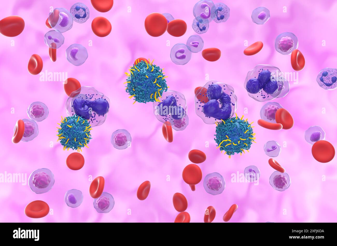 Terapia con cellule T di CAR nella leucemia mielogena cronica (LMC) - Vista isometrica illustrazione 3d. Foto Stock
