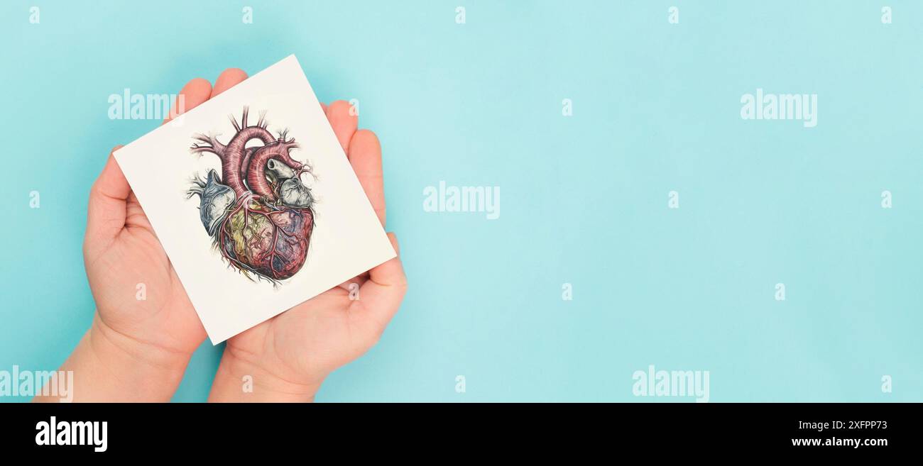 Attacco di cuore, malattia di miocardite, infiammazione del muscolo, trombosi dopo il vaccino, organo umano Foto Stock