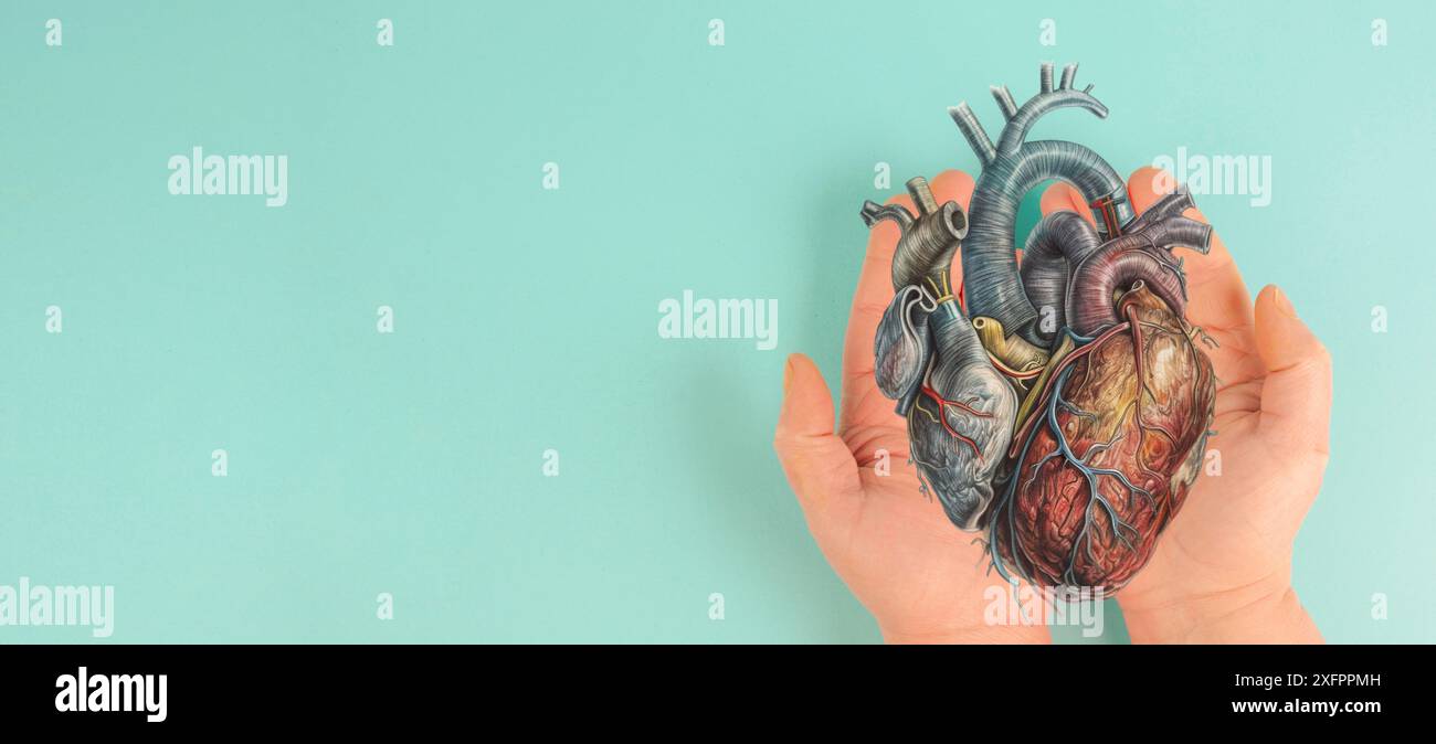 Infarto, malattia della miocardite, infiammazione del muscolo, trombosi e stress cardiaco, mani che tengono l'organo umano Foto Stock