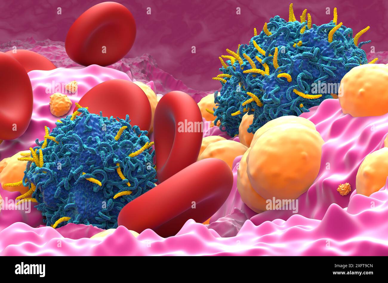 Terapia con cellule T di CAR nel carcinoma basocellulare (CCN) - Vista ravvicinata illustrazione 3d. Foto Stock