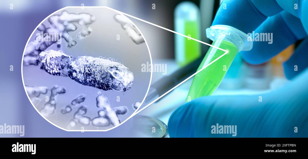 La mano del medico polmoni infetti concetto, tubercolosi presenza di infezione da micobatterio, tubercolosi batterica, cancro polmonare e malattia polmonare Foto Stock