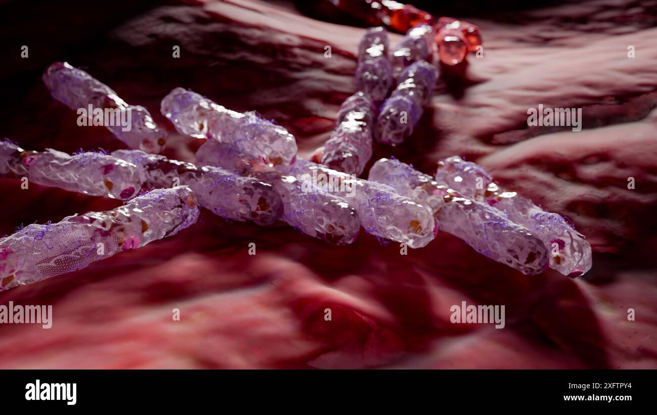 La mano del medico polmoni infetti concetto, tubercolosi presenza di infezione da micobatterio, tubercolosi batterica, cancro polmonare e malattia polmonare Foto Stock La mano del medico polmoni infetti concetto, tubercolosi presenza di infezione da micobatterio, tubercolosi batterica, cancro polmonare e malattia polmonare Foto Stock