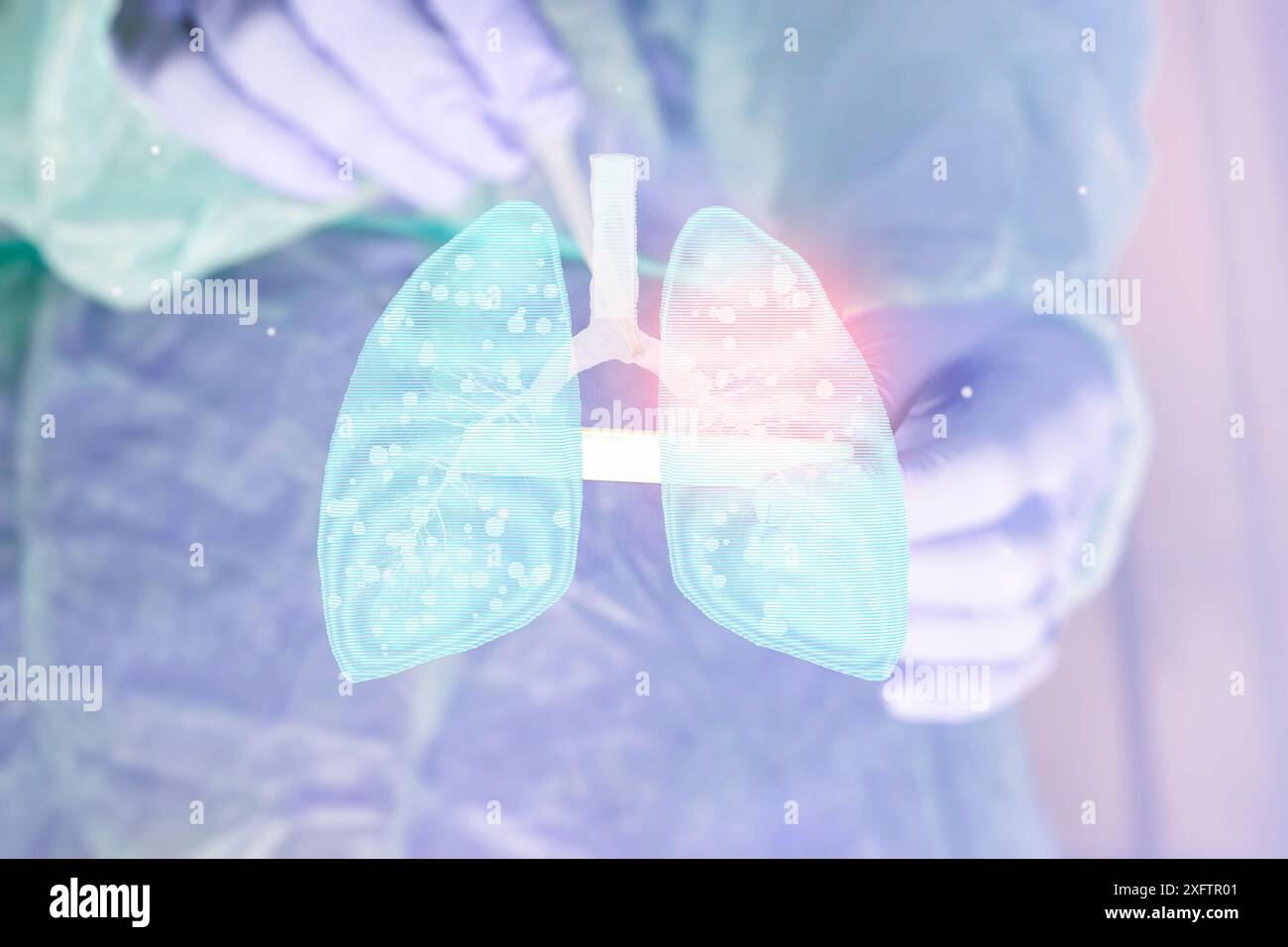 La mano del medico polmoni infetti concetto, tubercolosi presenza di infezione da micobatterio, tubercolosi batterica, cancro polmonare e malattia polmonare Foto Stock La mano del medico polmoni infetti concetto, tubercolosi presenza di infezione da micobatterio, tubercolosi batterica, cancro polmonare e malattia polmonare Foto Stock