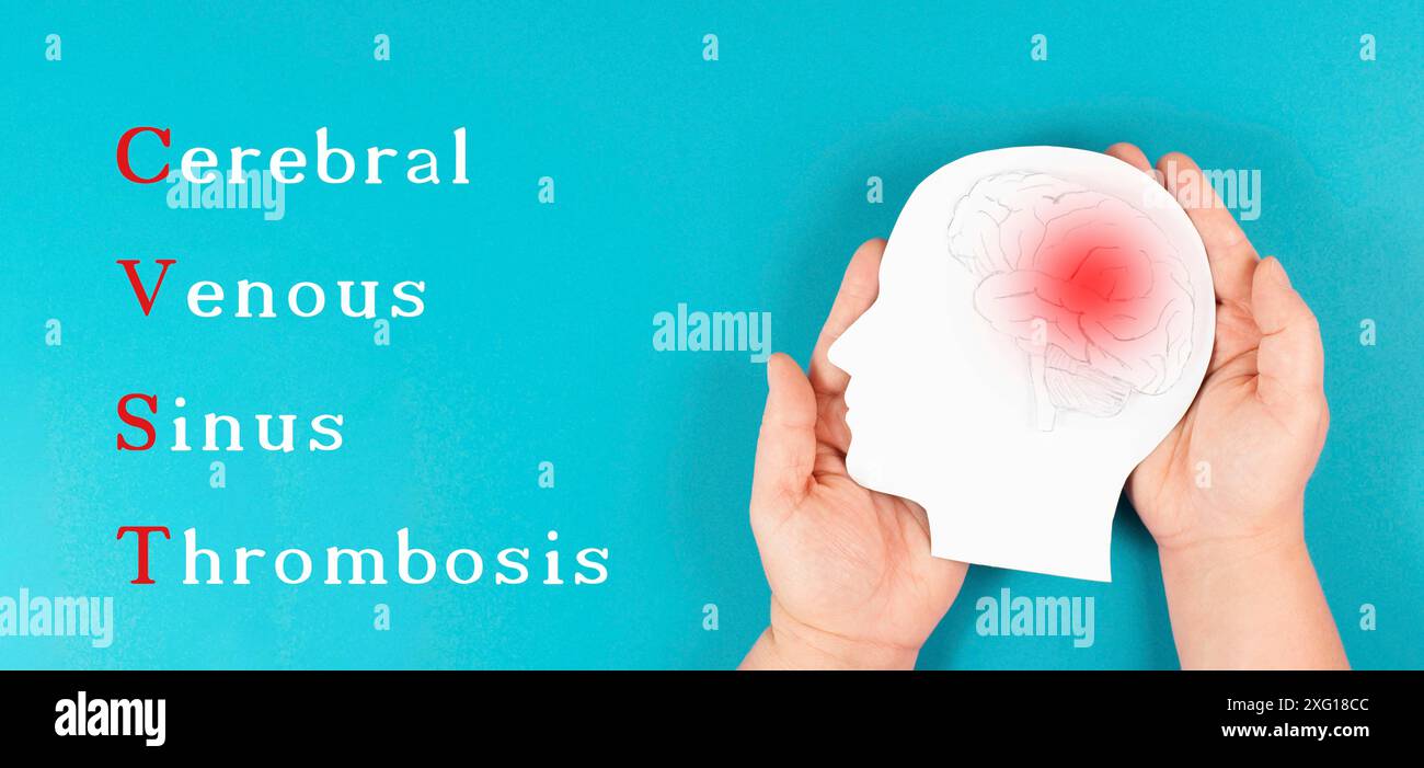 Trombosi venosa cerebrale del seno è in piedi sullo sfondo, Silhouette di una testa con un cervello, coagulo di sangue rosso, effetto collaterale vaccino covid-19 Foto Stock
