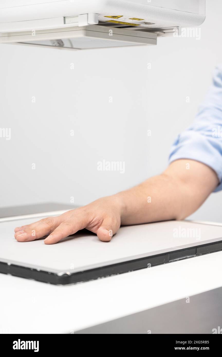 Uomo in sala radiologica che ha un esame medico in un ospedale moderno. Foto di alta qualità Foto Stock