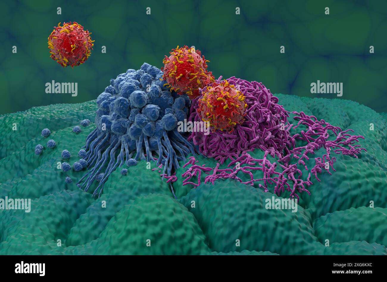 Terapia con cellule T DELL'AUTOMOBILE nel cancro dello stomaco (cancro gastrico) - Vista ravvicinata illustrazione 3d. Foto Stock
