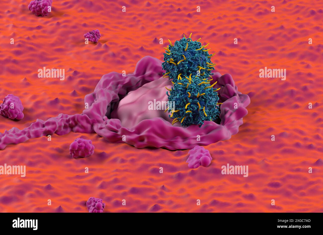 Terapia con cellule T di CAR nel colon, cancro colorettale (CRC) - Vista ravvicinata illustrazione 3d. Foto Stock