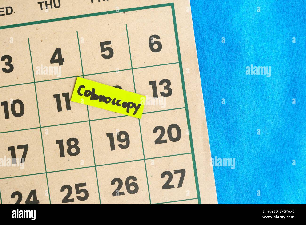 Colonoscopy medical procedure schedule concept. Written reminder note on calendar. Foto Stock