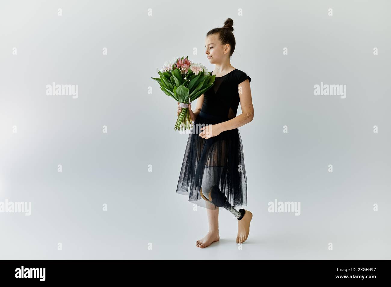 Una giovane ragazza con una gamba protesica tiene un bouquet di fiori in uno studio. Foto Stock