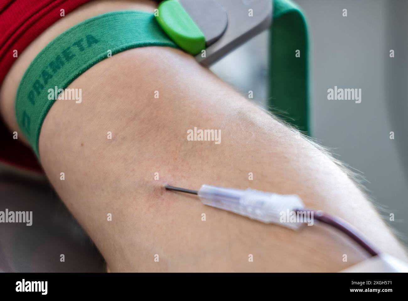06 luglio 2024, Brandeburgo, Cottbus: Il sangue di un uomo scorre da una vena attraverso una cannula bloccata nel truffatore del braccio durante una donazione di sangue. Il braccio dell'uomo è legato con una fascia elastica sopra il truffatore del braccio. Foto: Frank Hammerschmidt/dpa Foto Stock