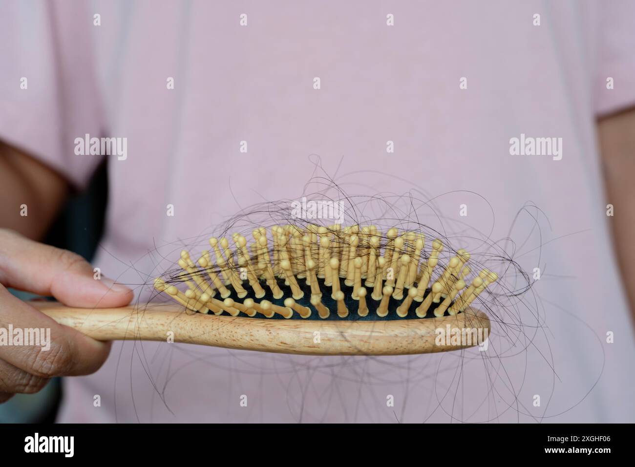 Caduta dei capelli in spazzola problema di stress della donna. Giovane donna che tiene in mano una spazzola mostrando il pettine che pulisce i capelli con un lungo problema di perdita dopo la pulizia. Foto Stock