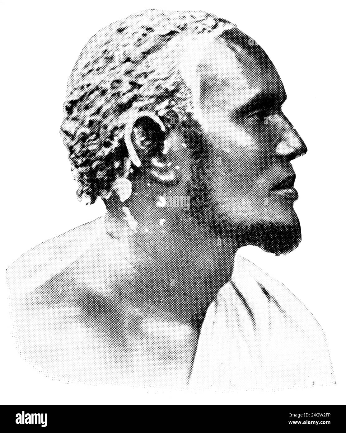 Popoli africani. Il ritratto del Madhiban (Madhibaan), noto anche come Gaboye, è una casta artigianale tra il popolo somalo. Foto Stock