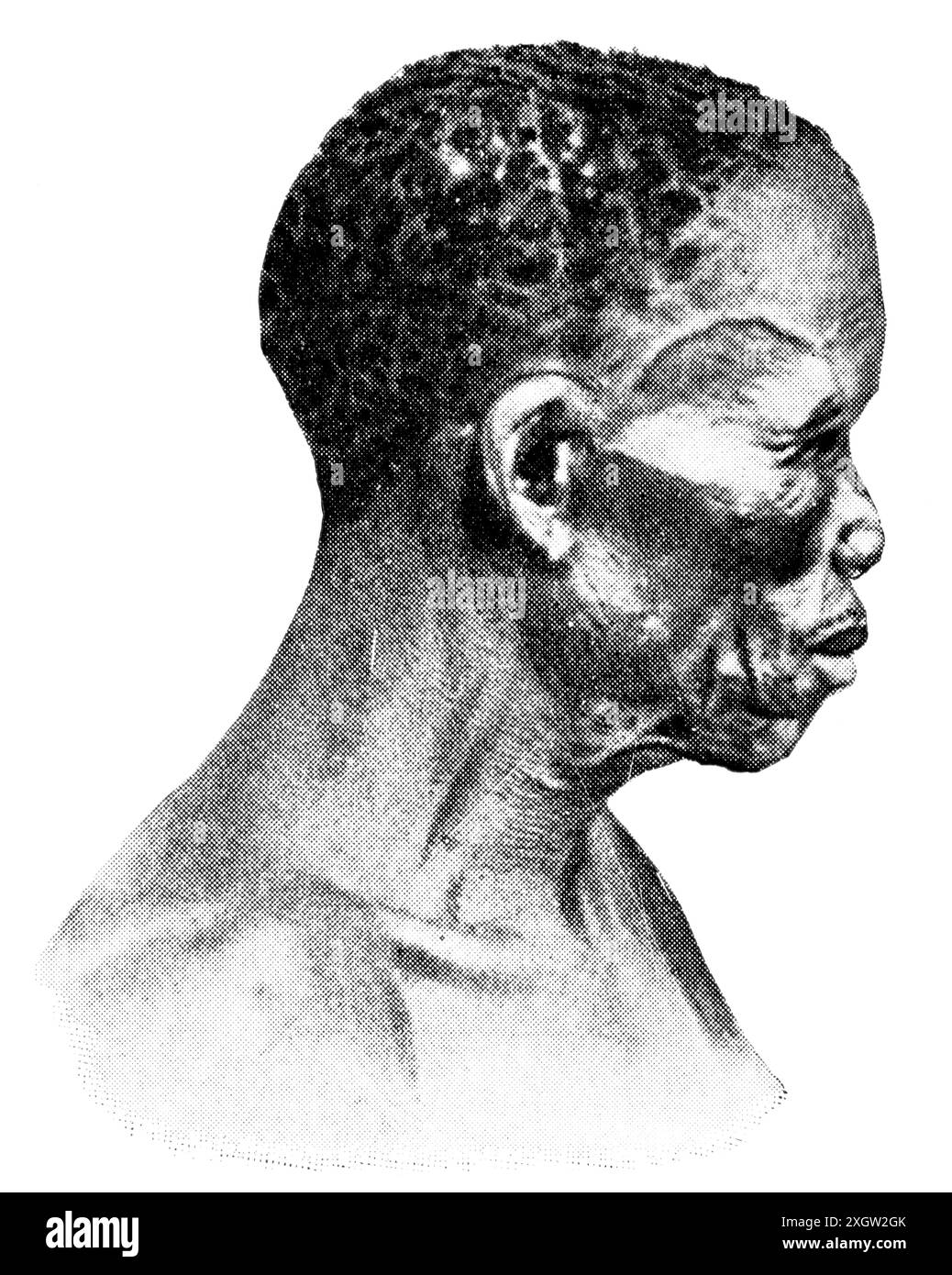 Popoli africani. Ritratto di un popolo Boscimani o San (anche Saan). Pubblicazione della "Meyers enciclopedia", volume 7, Lipsia, Germania, 1910 Foto Stock