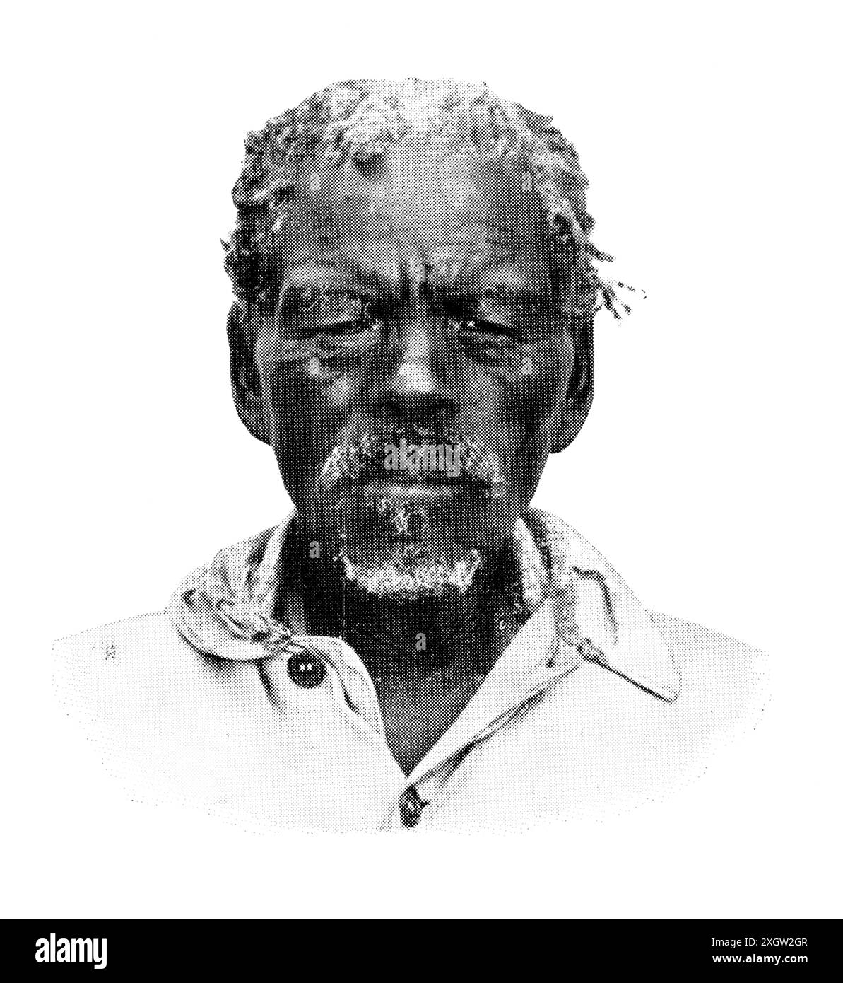Popoli africani. Ritratto di un Hottentot o Khoekhoe, i pastori nomadi indigeni del Sud Africa. Foto Stock