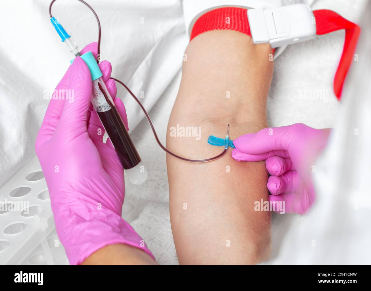 Il medico prende il sangue da una vena. Procedura PRP e concetto cosmetologico. Foto Stock