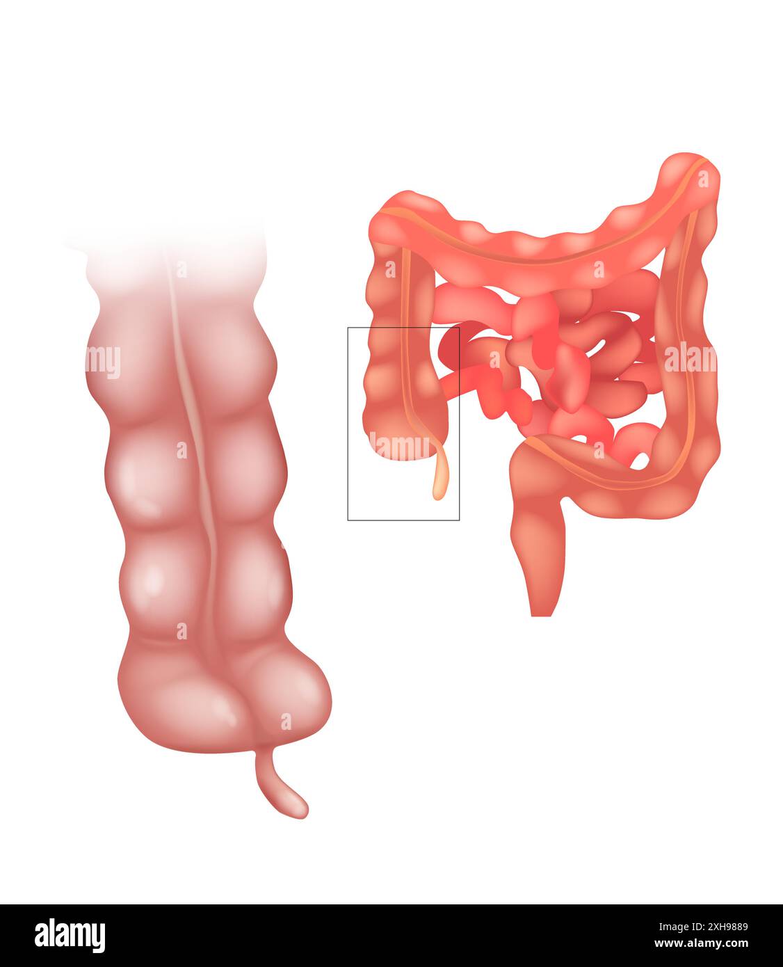 L'appendice o le appendici, le appendici, anche l'appendice vermiforme. Anatomia umana Illustrazione Vettoriale