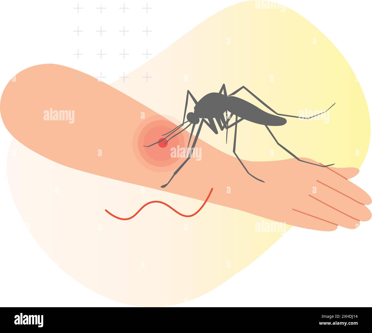 Puntura di zanzare sulla pelle umana - illustrazione stock come file EPS 10 Illustrazione Vettoriale
