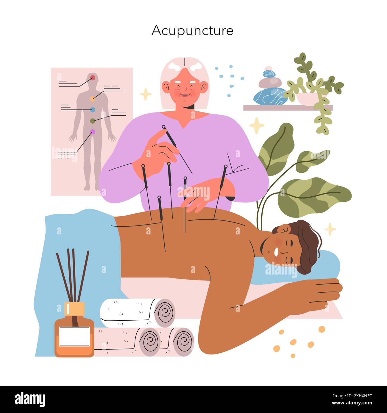 Concetto di medicina alternativa. Immagine della terapia di agopuntura con il medico che inserisce gli aghi nel paziente. Trattamento olistico di salute. Illustrazione vettoriale. Illustrazione Vettoriale