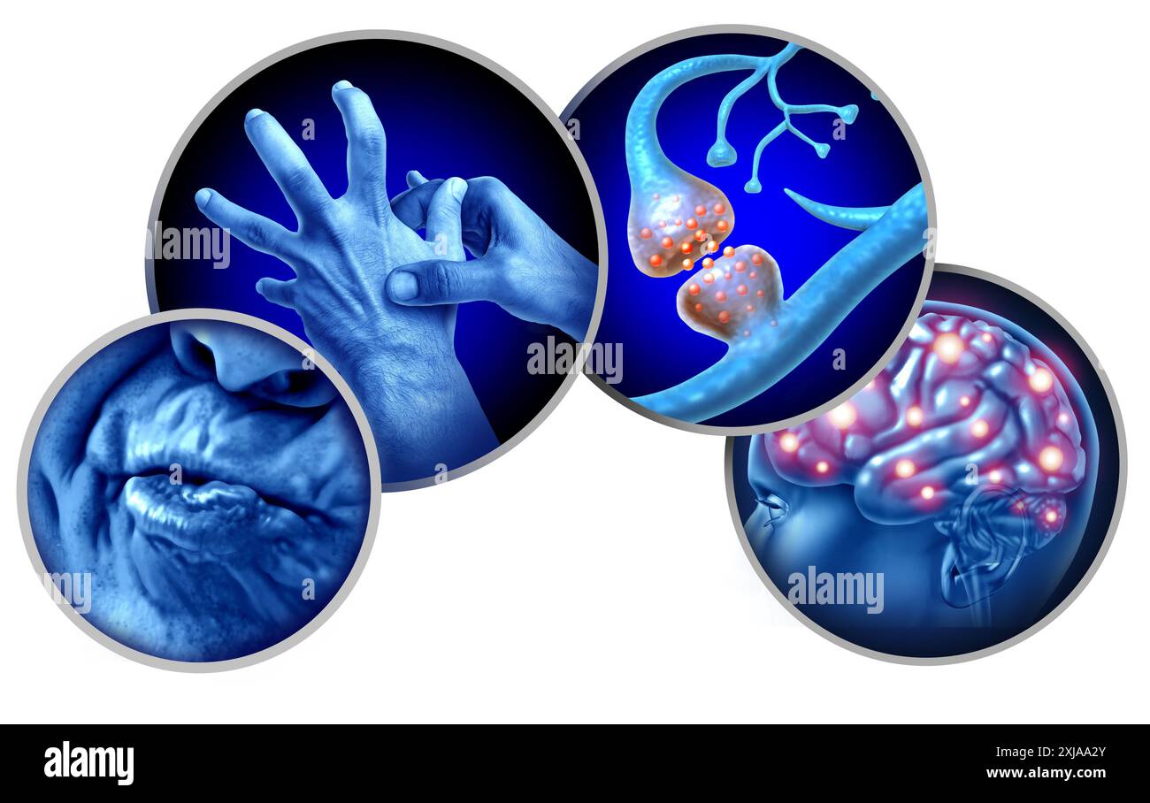 Discinesia tardiva TD come un disturbo neurologico che determina un disturbo involontario del movimento ripetitivo come una malattia della neurologia cerebrale dovuta alla dopamina Foto Stock
