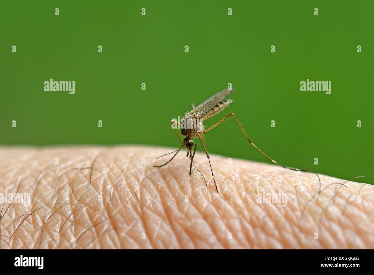 Morso di zanzara sulla pelle umana. Foto Stock