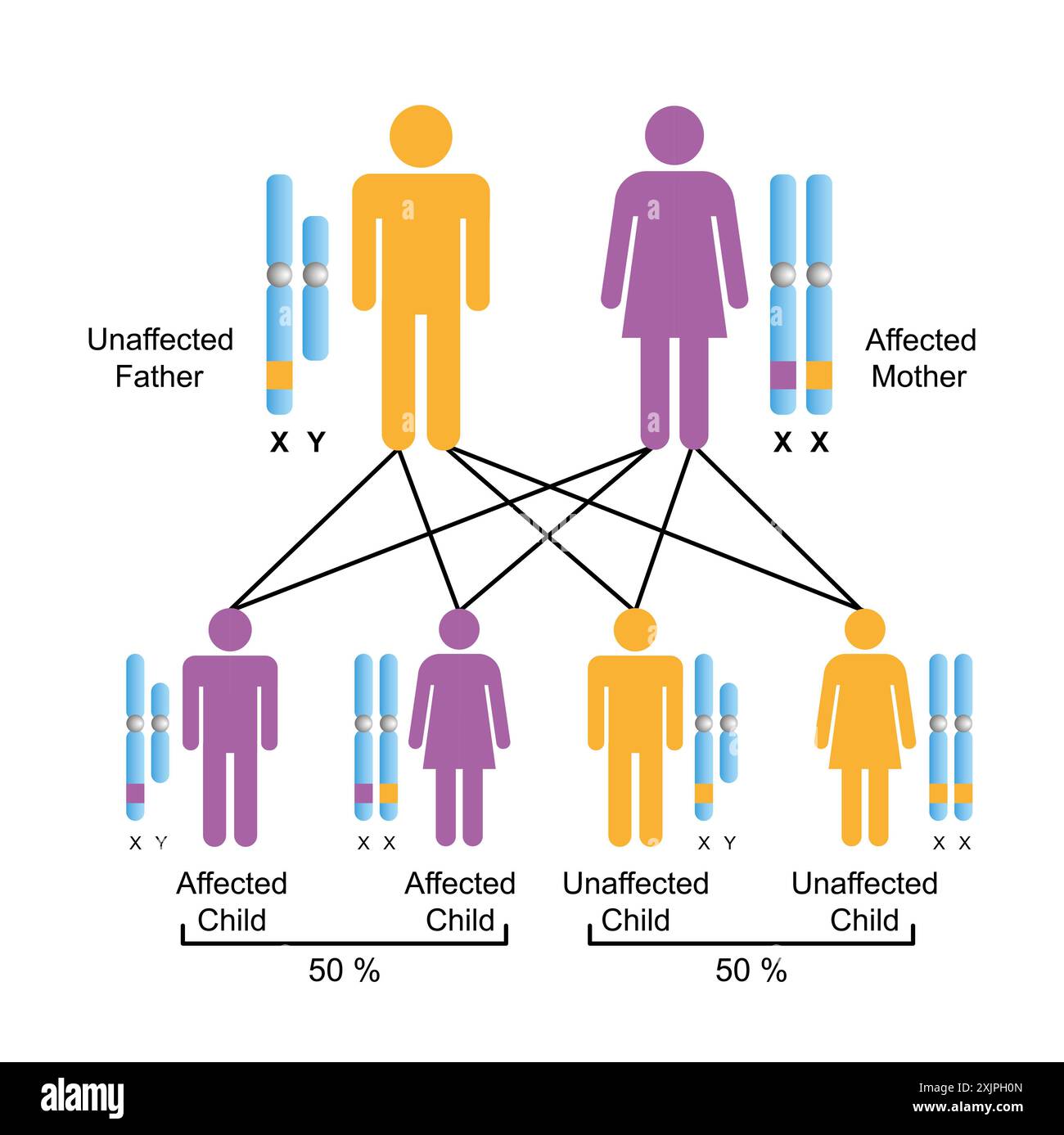 Ereditarietà dominante collegata a X, illustrazione. Foto Stock